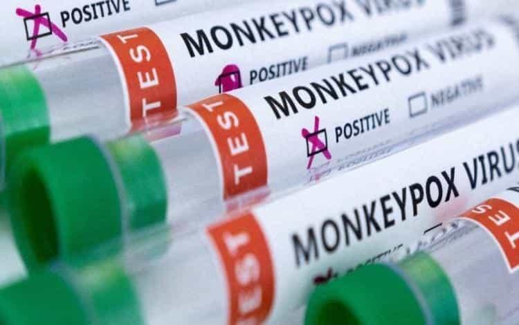 Confirman primeros 2 casos de viruela del mono en el estado de Morelos
